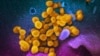 Study Shows British Patient Had COVID-19 for 505 Days
