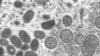 16x9 Image