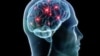 Scientists Create Device to Turn Brain Signals into Speech