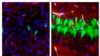 Scientists Restore Some Activity in Brains from Dead Pigs