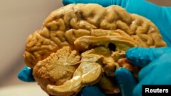 FILE - A human brain at the Institute of Experimental Medicine of Hungarian Academy of Science in Budapest March 16, 2011. New research shows that human brains learn language in memory systems that are old. Really old! (REUTERS/Laszlo Balogh)