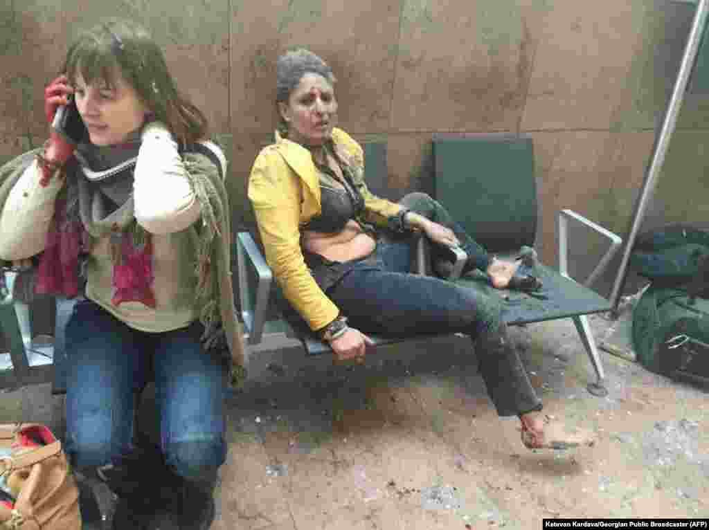 An injured woman looks on as another speaks on her mobile phone following twin blasts at Brussels airport in Zaventem, Belgium, March 22, 2016. Islamic State group (IS) millitants launched attacks at the city's airport and in a Metro train, killing more than 30 people and injuring more than 200 people.