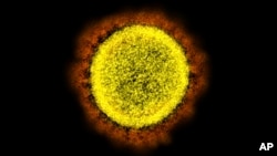 This 2020 electron microscope image made available by the National Institute of Allergy and Infectious Diseases shows a Novel Coronavirus SARS-CoV-2 particle isolated from a patient, in a laboratory in Fort Detrick, Maryland. (NIAID/NIH via AP, File)
