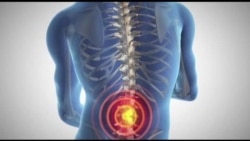 HLSpinalQ1