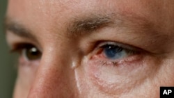Phil Durst, who has undergone an experimental stem cell procedure with his eyes, sits for a portrait in Homewood, Alabama, on Tuesday, Aug. 15, 2023. (AP Photo/Butch Dill)